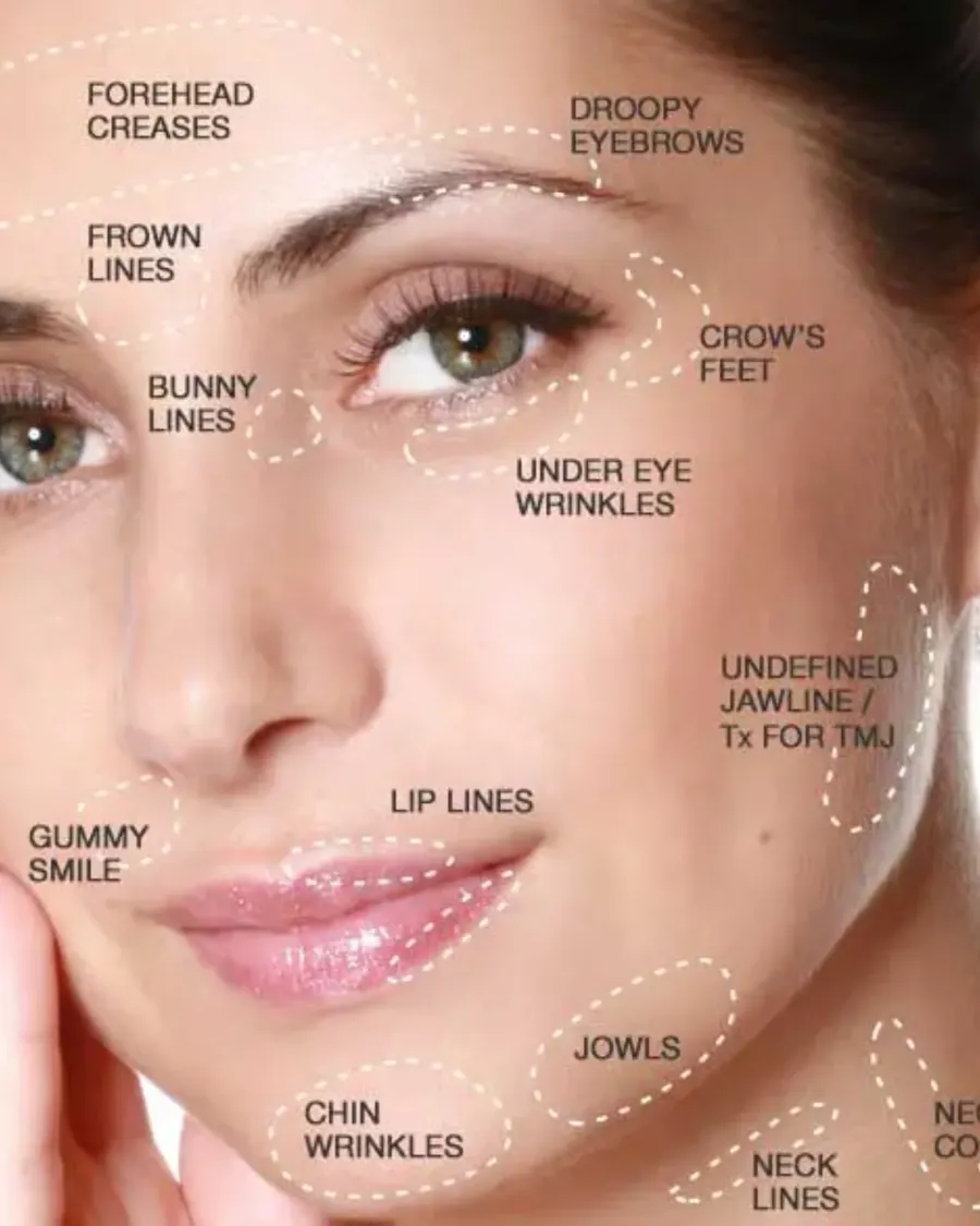 Botox at Cinch Clinics